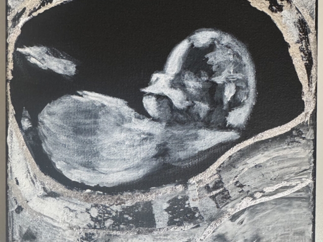 Baby_Scan_Mono_Collection
